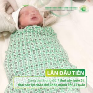 Sản phụ song thai sinh bé trai thứ hai khỏe mạnh, sau khi sẩy thai bé đầu tiên
/// Ảnh: BV Phụ sản Hà Nội cung cấp