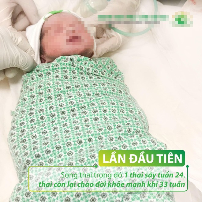 Sản phụ song thai sinh bé trai thứ hai khỏe mạnh, sau khi sẩy thai bé đầu tiên
/// Ảnh: BV Phụ sản Hà Nội cung cấp