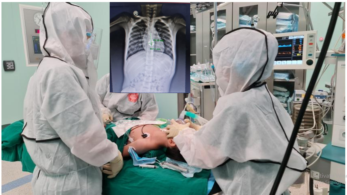 Y bác sĩ nội soi đường tiêu hóa của bé N., gắp ra được chiếc chìa khóa /// Ảnh: BVCC