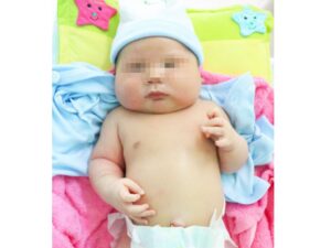 Bé trai 5,2 kg sinh mổ tại Bệnh viện Hoàn Mỹ Bình Phước /// ẢNH: BVCC