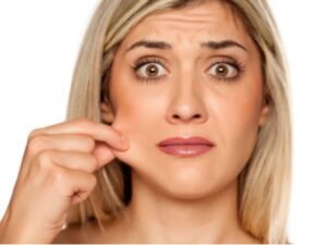 Khuôn mặt cũng tiết lộ nhiều vấn đề sức khỏe nghiêm trọng /// Ảnh minh họa: Shutterstock