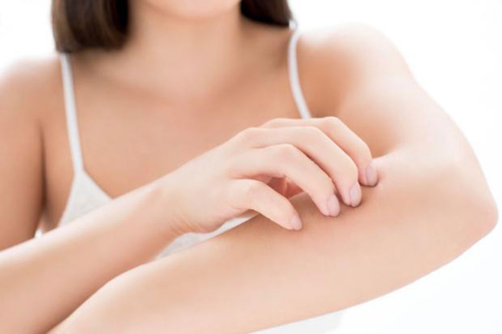 skmoi_qaph Những người bị ngứa toàn thân có khả năng mắc bệnh ung thư tiềm ẩn cao /// Shutterstock