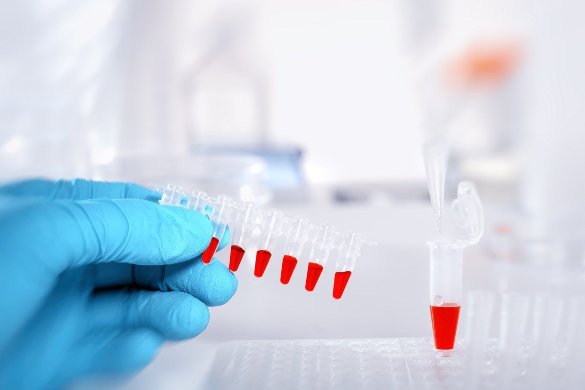 blood-samples-probes-dna-lab_nggc /// Ảnh minh họa: Shutterstock