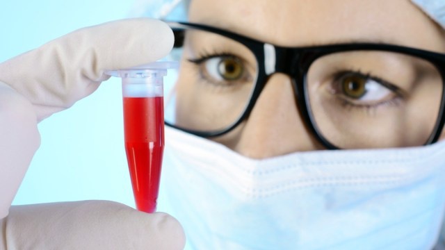 blood-test-probe-scientist-nurse-lab_jwwb /// Ảnh: Shutterstock