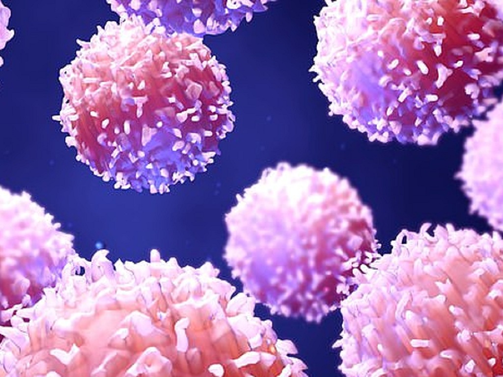 te-bao-lympho-shutterstock_qyvh Tế bào lympho lại là loại tế bào bạch cầu thuộc hệ miễn dịch, vốn có vai trò quan trọng giúp cơ thể chống chọi lại tác nhân gây bệnh /// Ảnh minh họa: Shutterstock