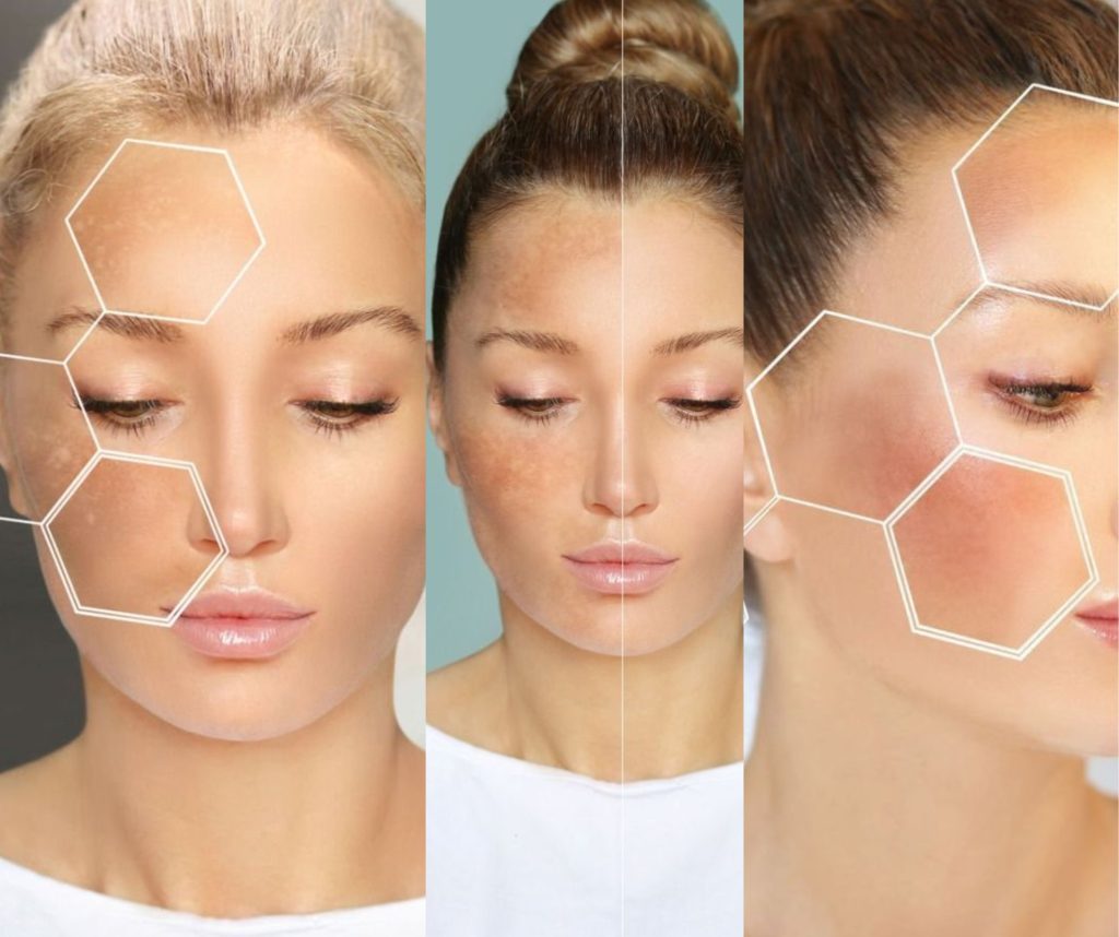 lợi ích uống collagen?